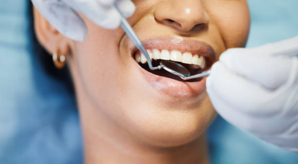 Best Emergency Treatment for Dental Infections or Abscesses in High Rolls, NM