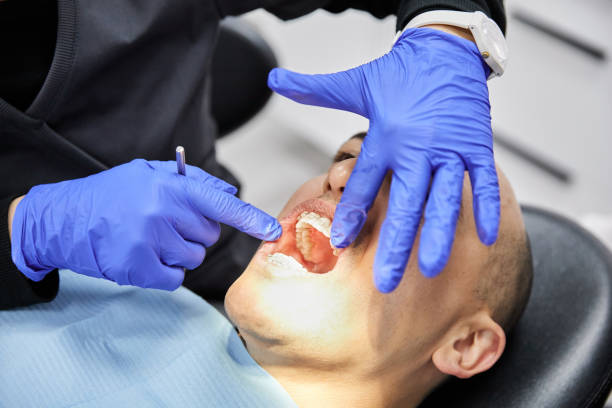 Best Emergency Tooth Extraction in High Rolls, NM